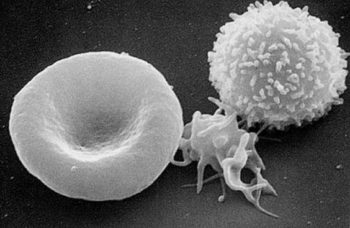 Focus sur : L&rsquo;immunothérapie