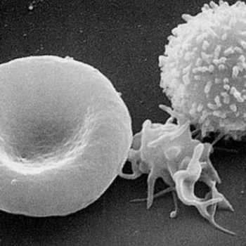 Focus sur : L&rsquo;immunothérapie
