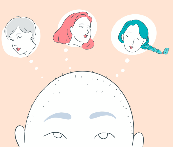 L&rsquo;alopécie, ou la perte des cheveux, en 10 questions