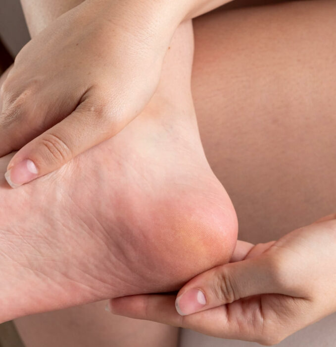4 étapes pour des jolis pieds, même pendant mon cancer !