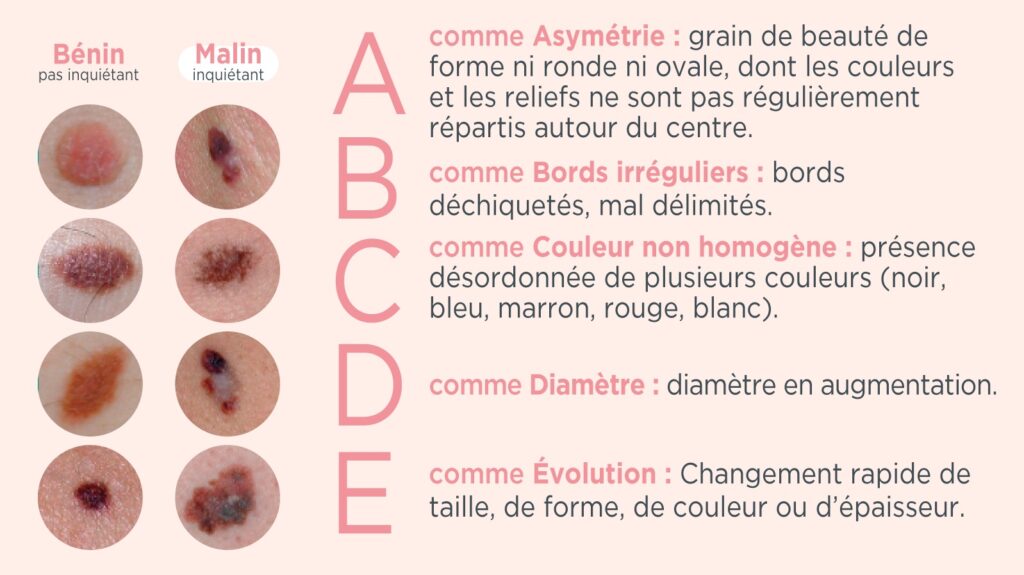 cancer peau symptômes mélanome - MÊME Cosmetics