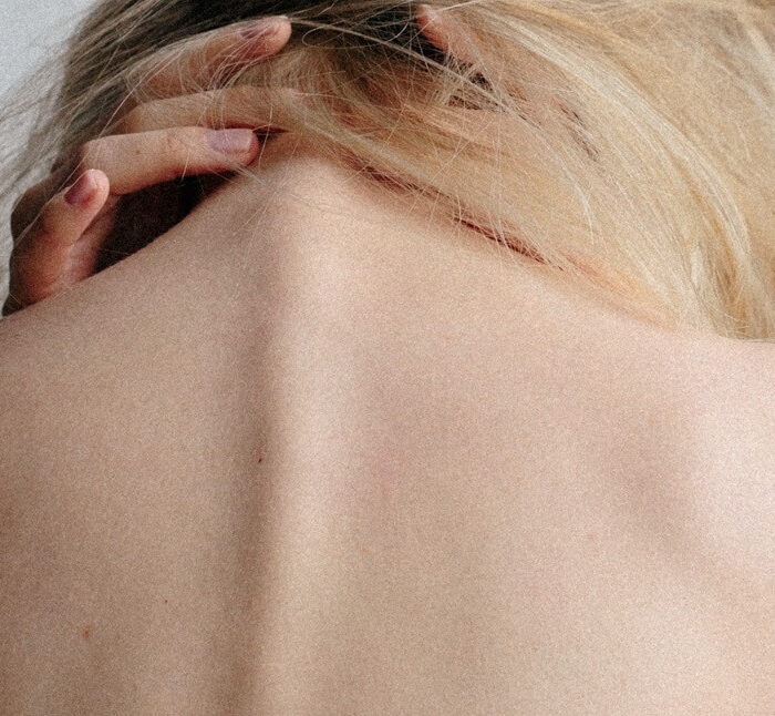 Prévenir la chute des cheveux lors de la chimiothérapie
