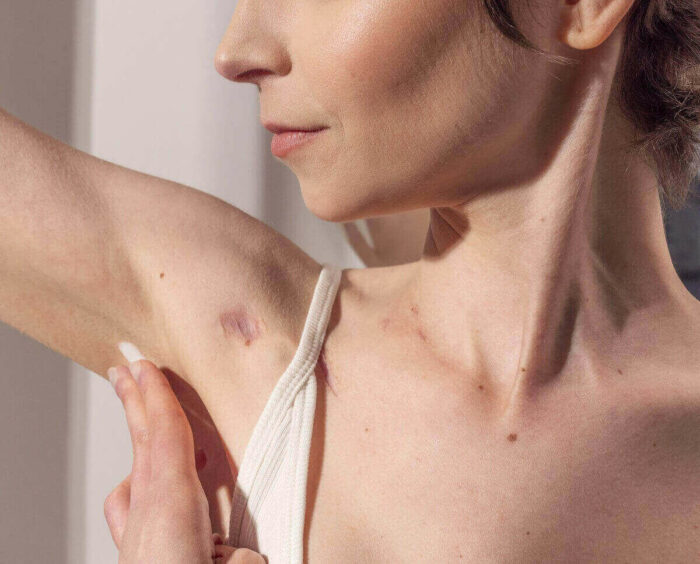 Vrai ou faux : quel déodorant choisir sans danger ?